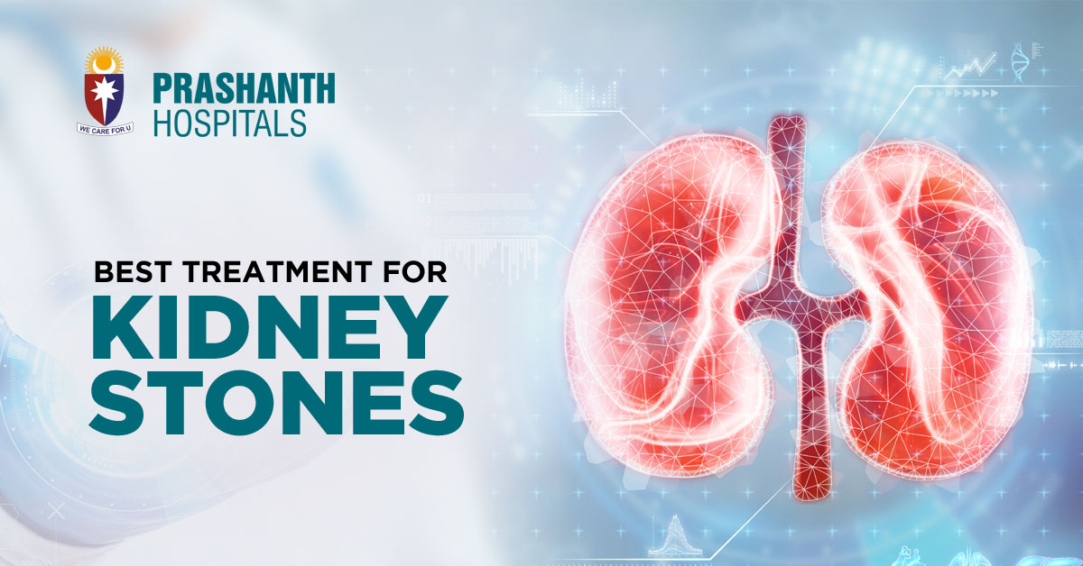 What Is The Best Treatment For Kidney Stones