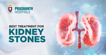 treatment-kidney-stones