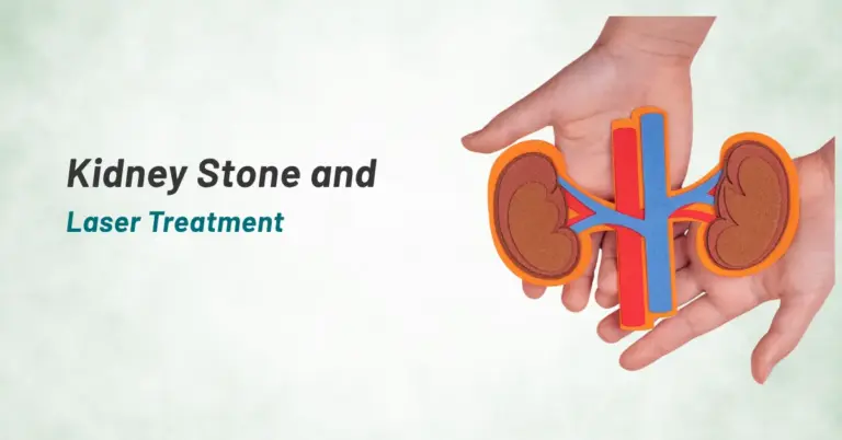 Kidney Stone and Laser Treatment