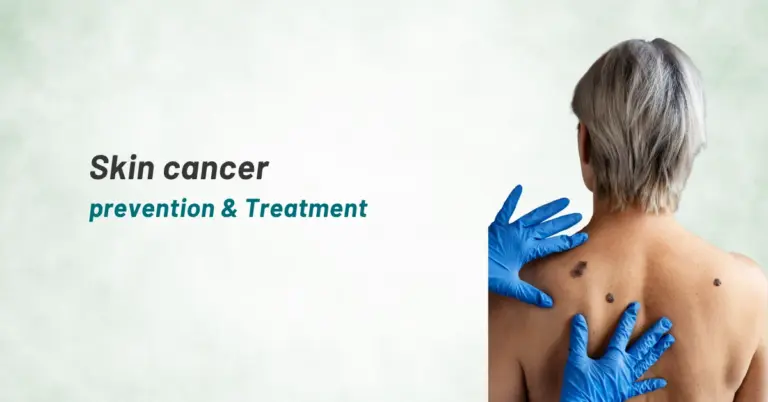 Skin cancer prevention & Treatment