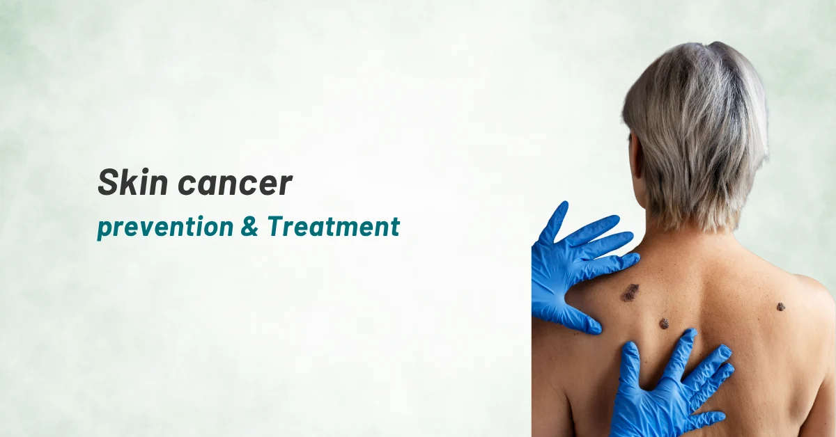 Skin cancer prevention & Treatment