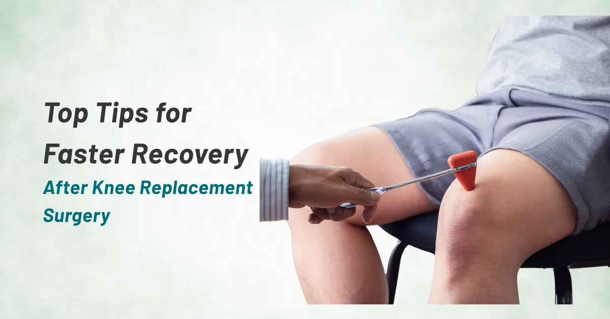 Top Tips for Faster Recovery After Knee Replacement Surgery