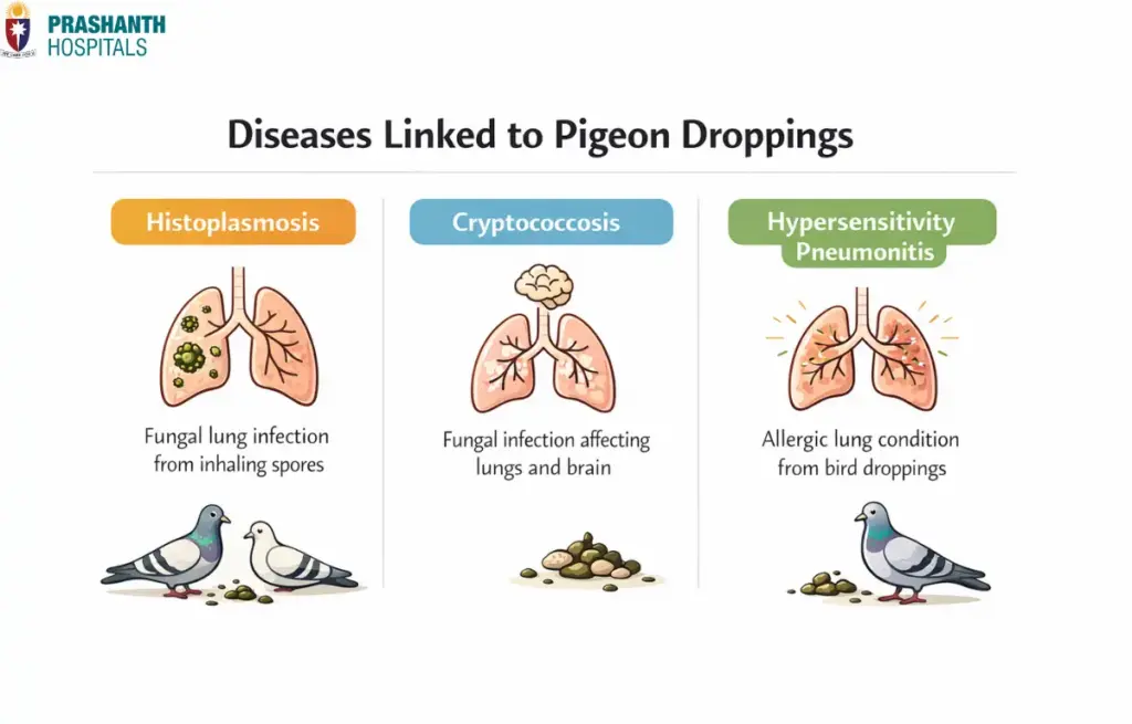 Diseases linked to pigeon droppings | pigeon lung disease