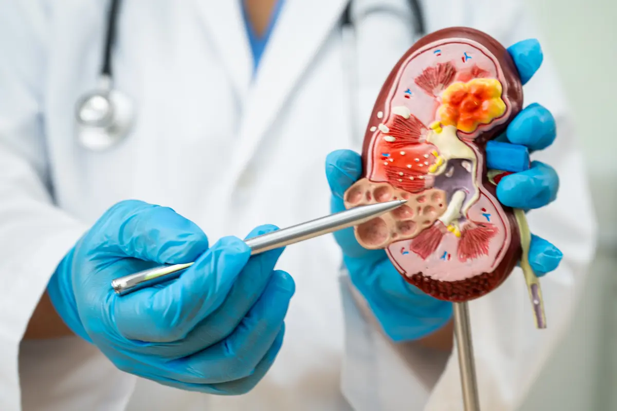 Important Things To Know Before Getting a Renal Transplant surgery