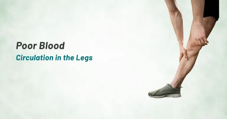 What Causes Poor Blood Circulation in the Legs?