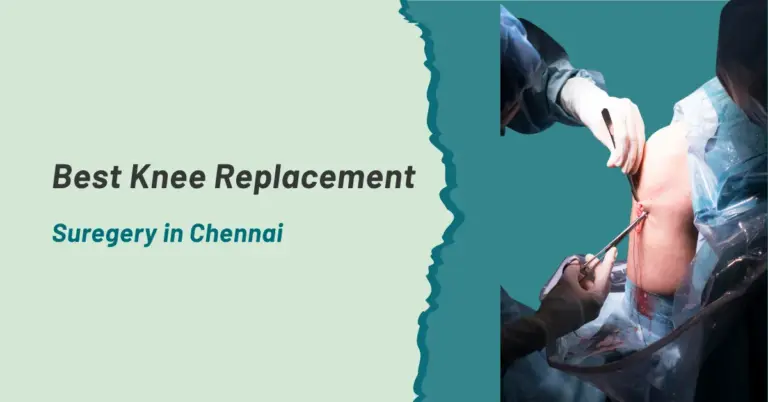 Best Knee Replacement Surgery in Chennai
