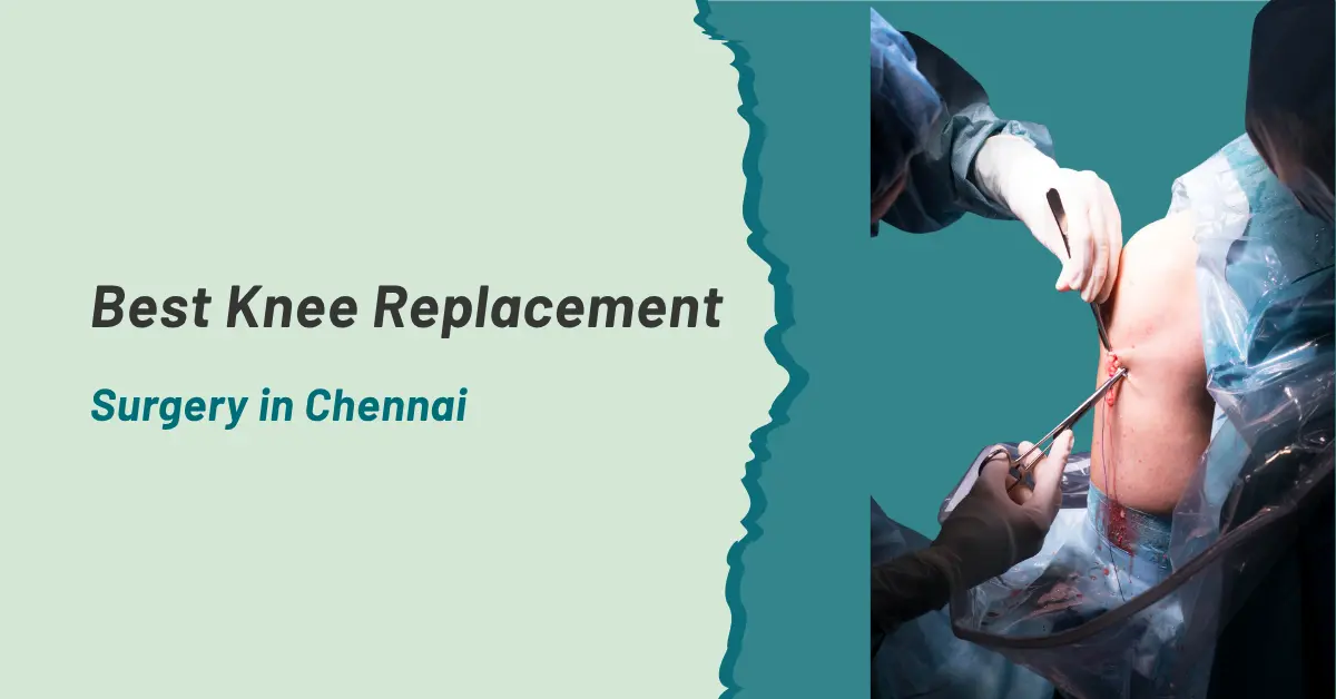Best Knee Replacement Surgery in Chennai