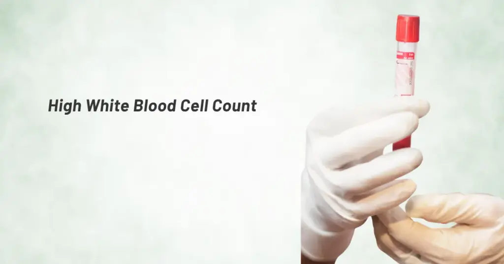 High White Blood Cell Count
