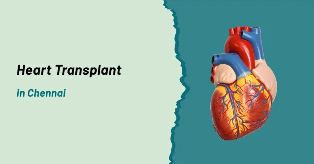 Heart Transplant in Chennai | Prashanth Hospitals