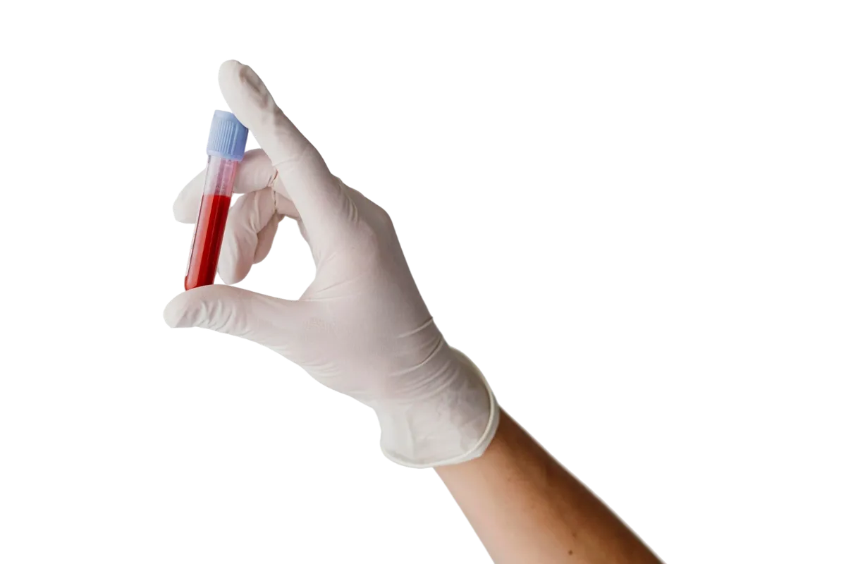 best hematology hospitals in Chennai