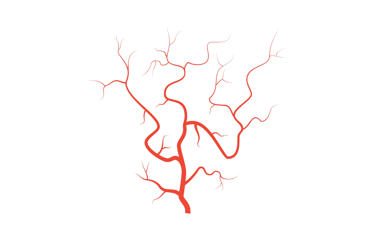 Vascular Surgery in Chennai