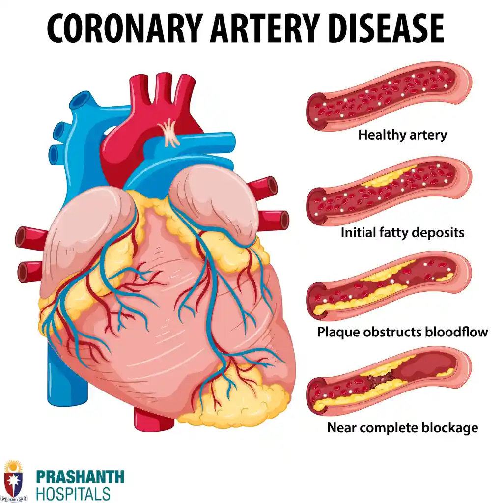 heart transplant in Chennai | Prashanth Hospitals