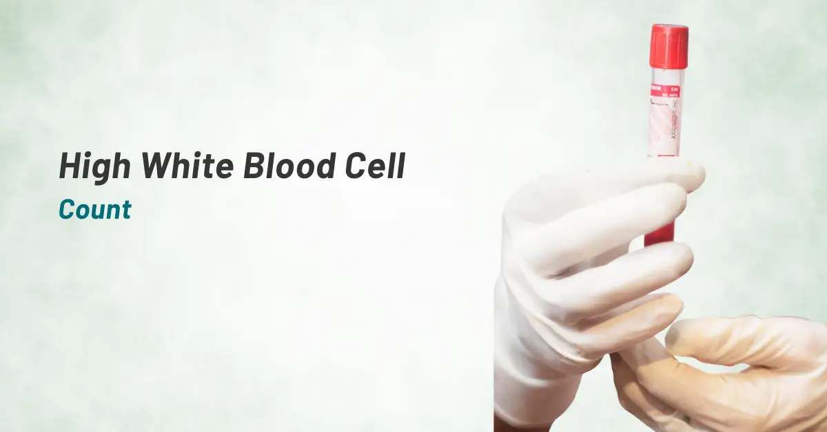 High White Blood Cell Count