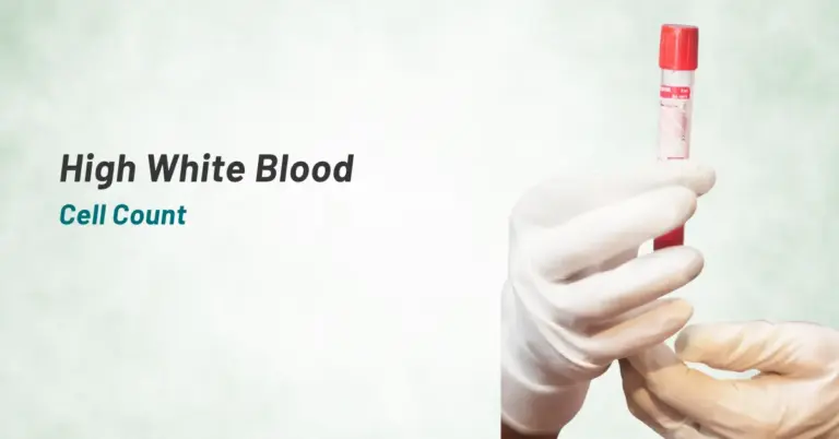 High White Blood Cell Count