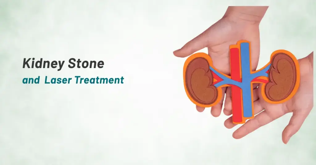 Kidney Stone and Laser Treatment