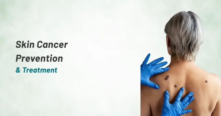 Skin cancer prevention & Treatment