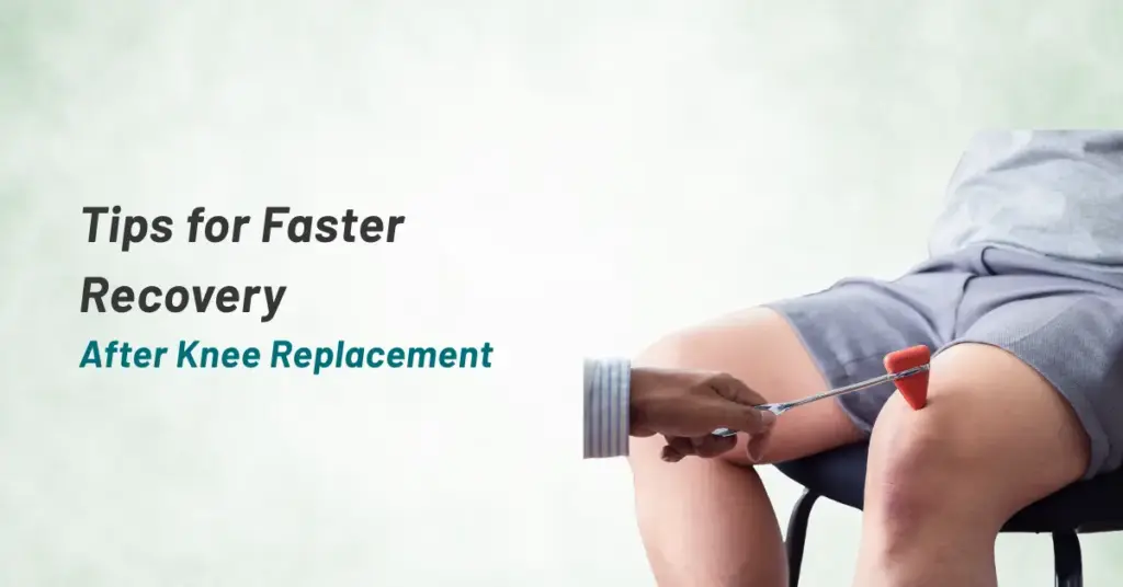 Top Tips for Faster Recovery After Knee Replacement Surgery