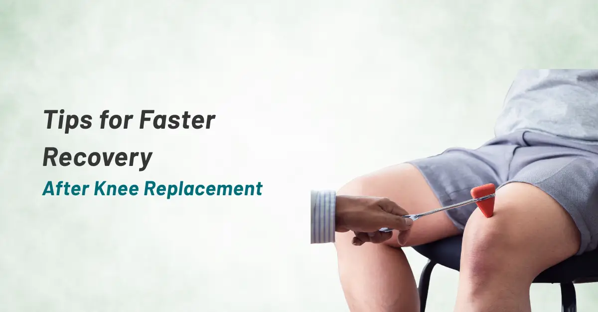 Top Tips for Faster Recovery After Knee Replacement Surgery