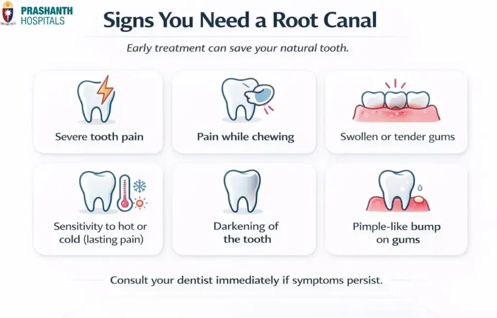 Signs you need a root canal | Dentist in Chennai