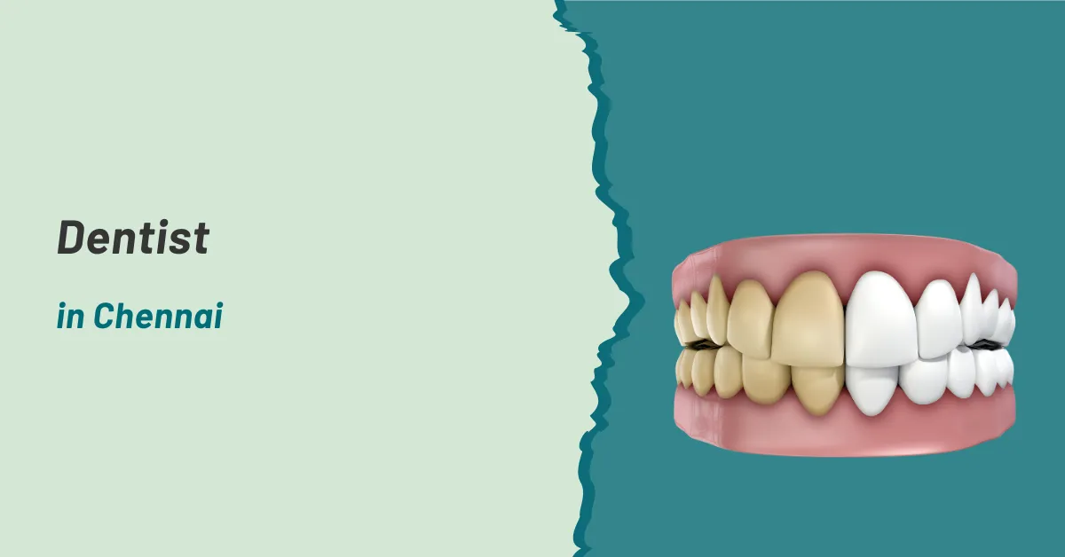 Dentist in Chennai | Prashanth Hospitals