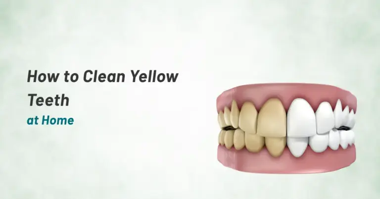 How to Clean Yellow Teeth at Home | Prashanth Hosptials
