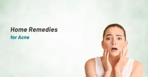 Home Remedies for Acne