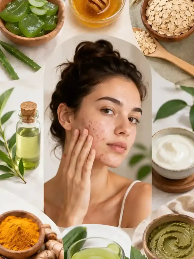 Home Remedies for Acne