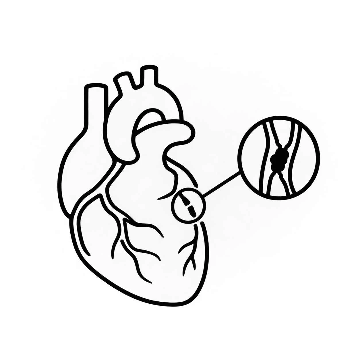 Chronic Total Occlusions CTO-50kb