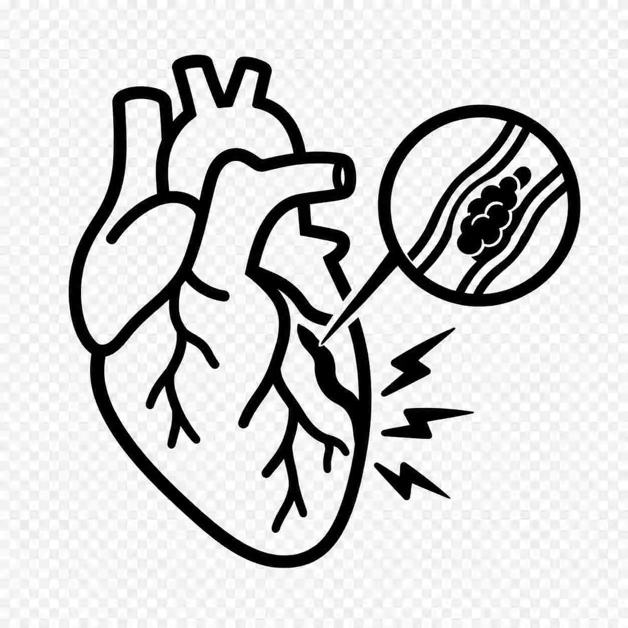 Clot-heavy heart attacks