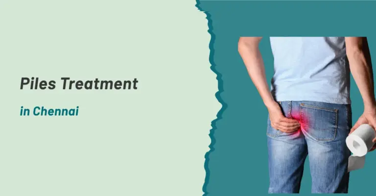 Piles Treatment in Chennai
