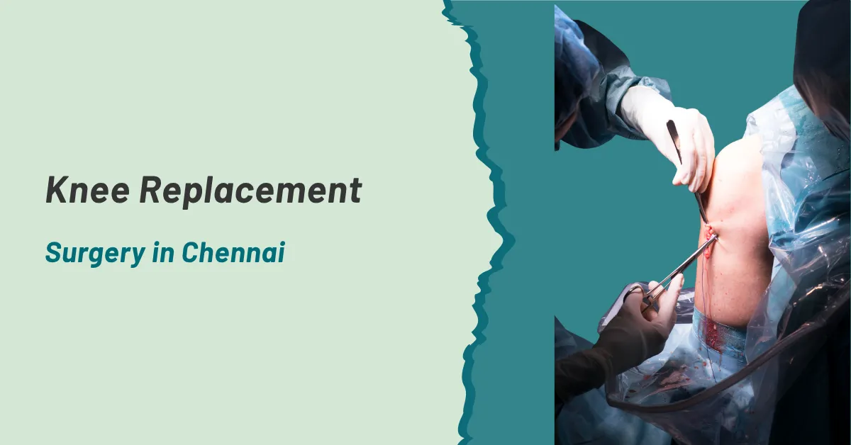 Knee Replacement Surgery in Chennai
