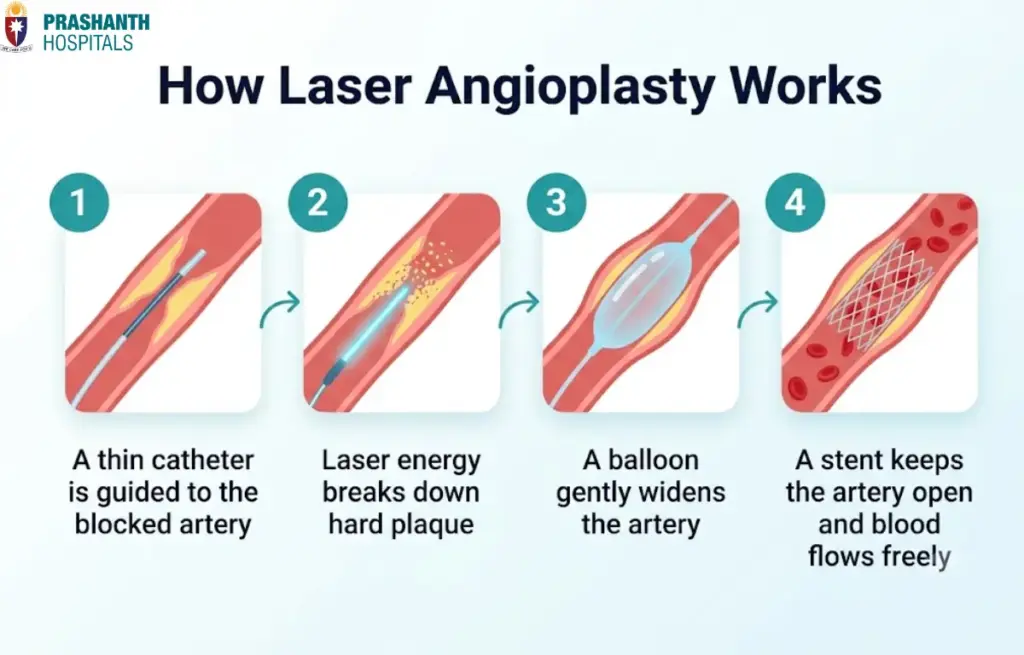 Laser Angioplasty Hospital in Chennai