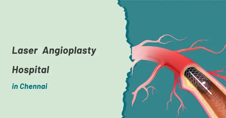 Laser Angioplasty Hospital in Chennai