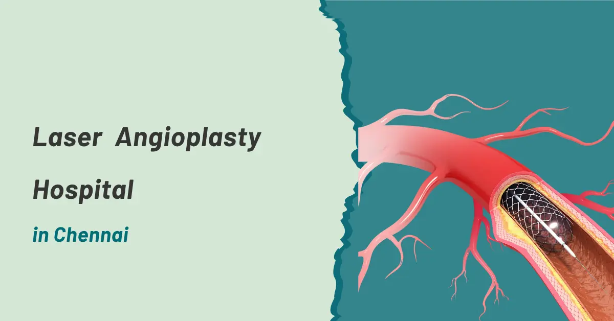 Laser Angioplasty Hospital in Chennai