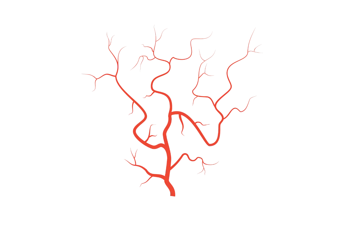 Vascular Surgery in Chennai